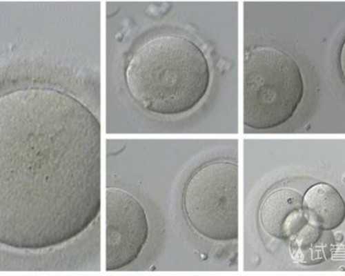 温州借卵生殖中心 温州供卵助孕机构排名已发布 ‘b超圆形状图片代表男孩女孩