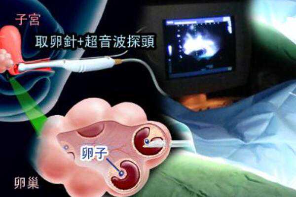 武汉选性别的试管医院 ​2023年武汉康健妇婴医院试管婴儿成功率评估(附真实成